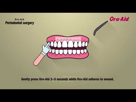 Ora-Aid : Periodontal Surgery